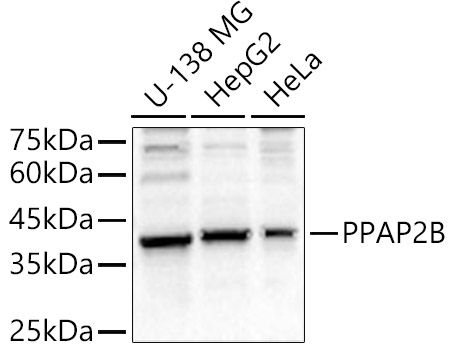 PPAP2B Rabbit Polyclonal Antibody