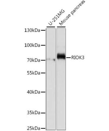 RIOK3 Rabbit Polyclonal Antibody
