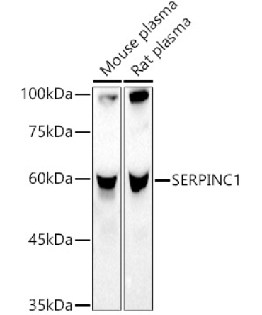 SERPINC1 Rabbit Polyclonal Antibody