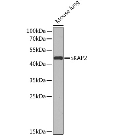 SKAP2 Rabbit Polyclonal Antibody