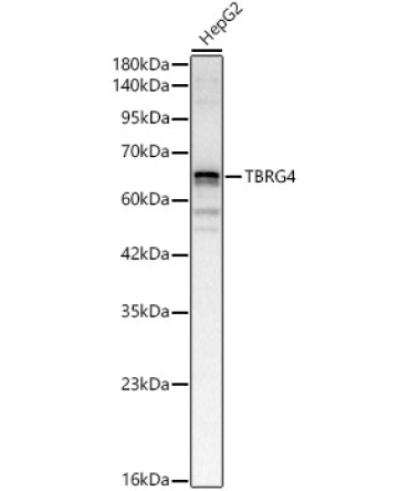 TBRG4 Rabbit Polyclonal Antibody
