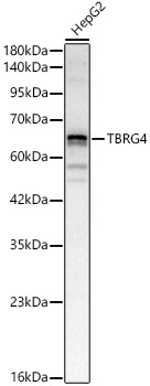 TBRG4 Rabbit Polyclonal Antibody