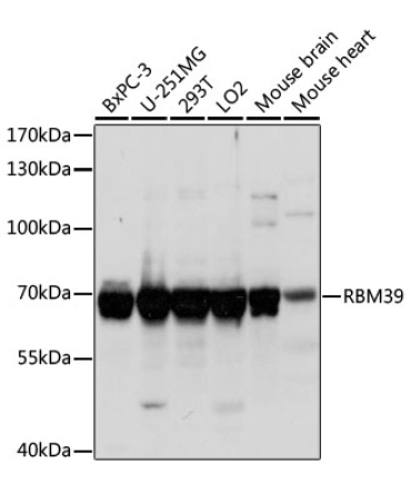 RBM39 Rabbit Polyclonal Antibody