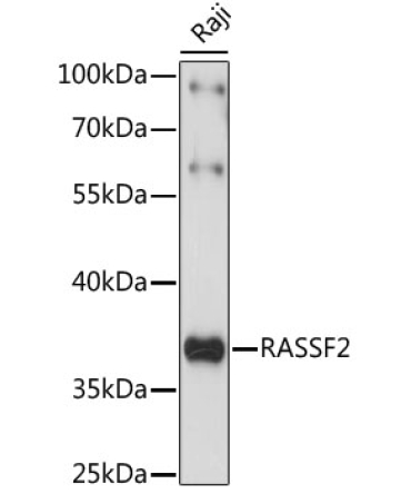 RASSF2 Rabbit Polyclonal Antibody