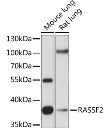 RASSF2 Rabbit Polyclonal Antibody