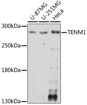 TENM1 Rabbit Polyclonal Antibody