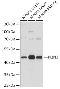 PLIN3 Rabbit Polyclonal Antibody