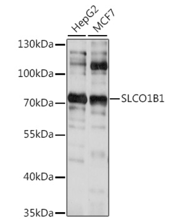 SLCO1B1 Rabbit Polyclonal Antibody
