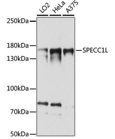 SPECC1L Rabbit Polyclonal Antibody