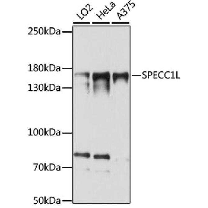 SPECC1L Rabbit Polyclonal Antibody