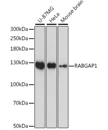 RABGAP1 Rabbit Polyclonal Antibody