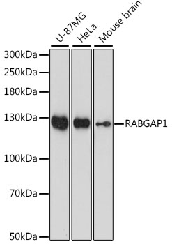 RABGAP1 Rabbit Polyclonal Antibody