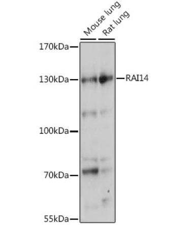 RAI14 Rabbit Polyclonal Antibody