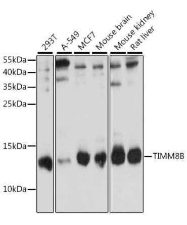 TIMM8B Rabbit Polyclonal Antibody