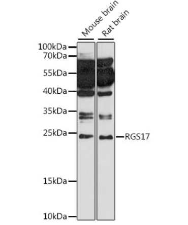 RGS17 Rabbit Polyclonal Antibody