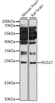 RGS17 Rabbit Polyclonal Antibody