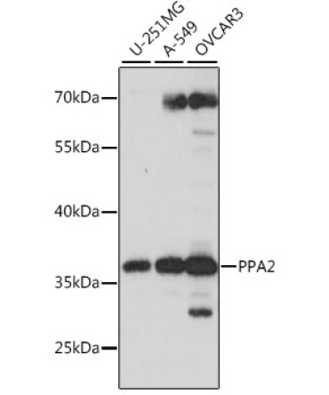 PPA2 Rabbit Polyclonal Antibody