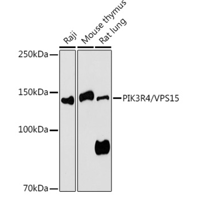 PIK3R4/VPS15 Rabbit Polyclonal Antibody