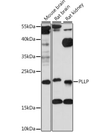 PLLP Rabbit Polyclonal Antibody