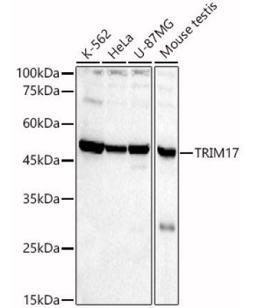 TRIM17 Rabbit Polyclonal Antibody