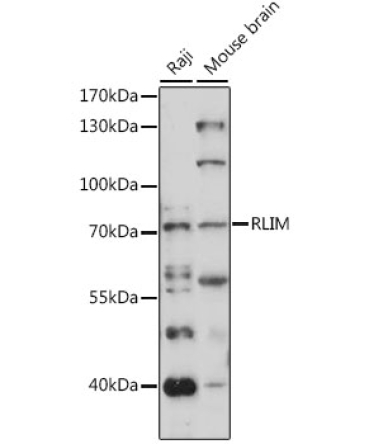 RLIM Rabbit Polyclonal Antibody