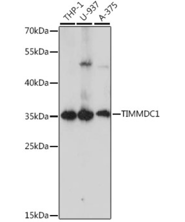 TIMMDC1 Rabbit Polyclonal Antibody