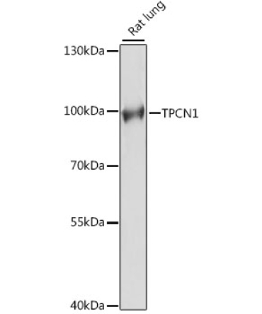 TPCN1 Rabbit Polyclonal Antibody