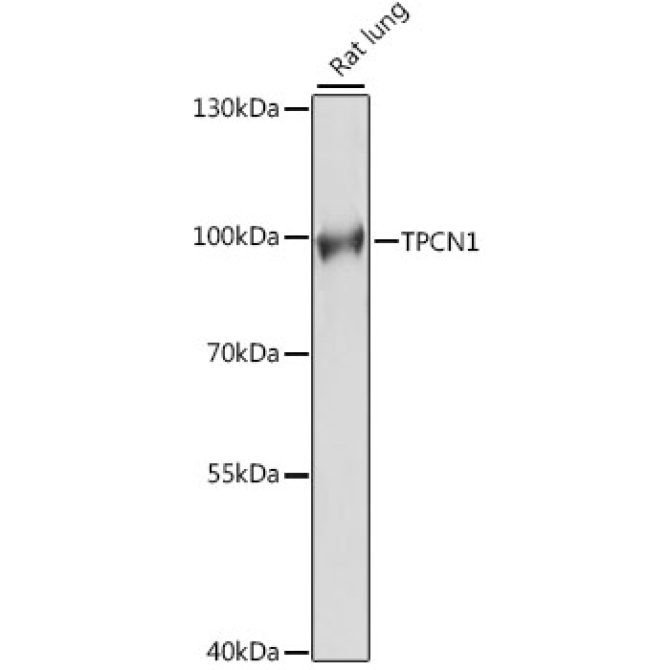 TPCN1 Rabbit Polyclonal Antibody