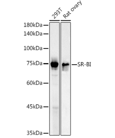 SR-BI Rabbit Polyclonal Antibody