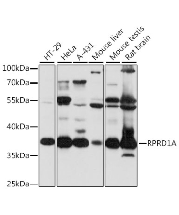 RPRD1A Rabbit Polyclonal Antibody