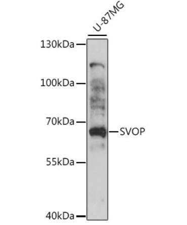 SVOP Rabbit Polyclonal Antibody