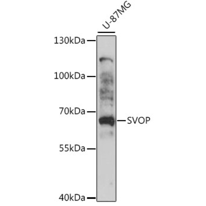 SVOP Rabbit Polyclonal Antibody