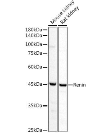 Renin Rabbit Polyclonal Antibody