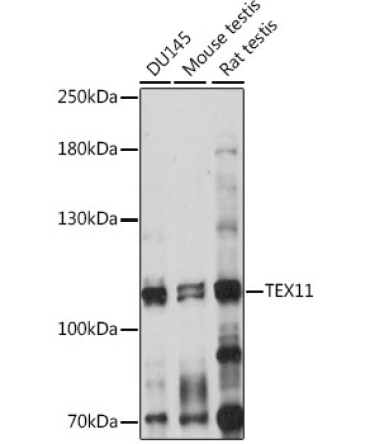 TEX11 Rabbit Polyclonal Antibody