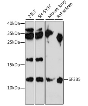 SF3B5 Rabbit Polyclonal Antibody