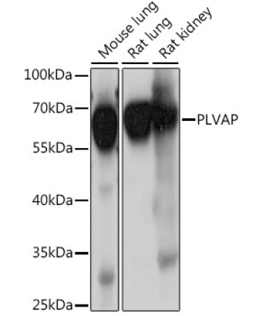 PLVAP Rabbit Polyclonal Antibody