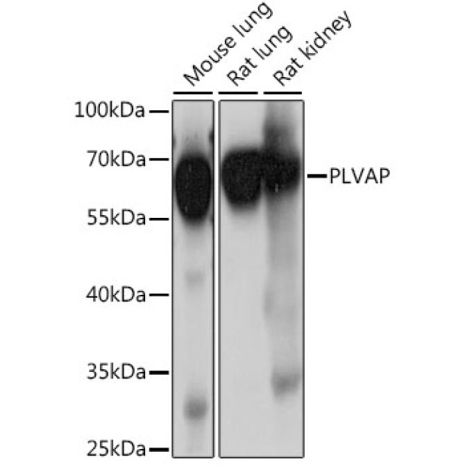 PLVAP Rabbit Polyclonal Antibody