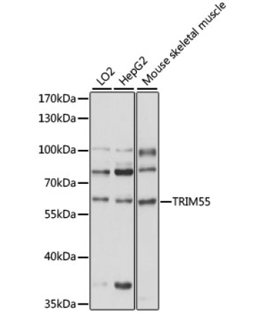 TRIM55 Rabbit Polyclonal Antibody