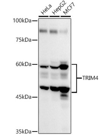 TRIM4 Rabbit Polyclonal Antibody