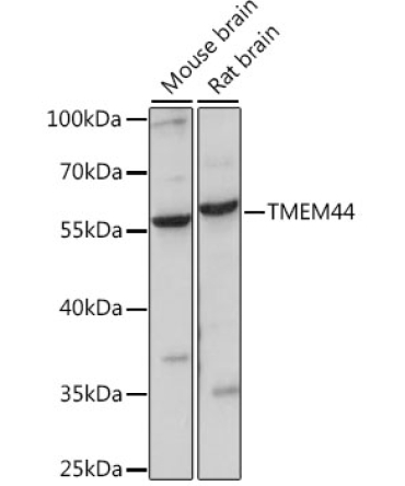 TMEM44 Rabbit Polyclonal Antibody