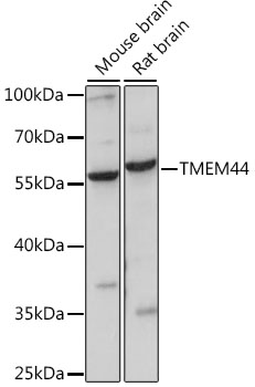 TMEM44 Rabbit Polyclonal Antibody