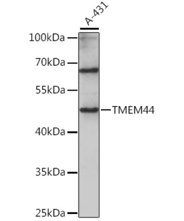 TMEM44 Rabbit Polyclonal Antibody