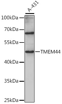 TMEM44 Rabbit Polyclonal Antibody