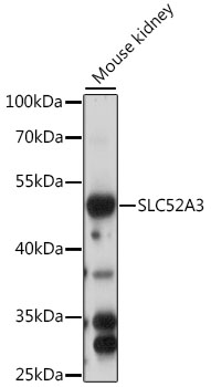 SLC52A3 Rabbit Polyclonal Antibody