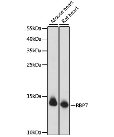 RBP7 Rabbit Polyclonal Antibody