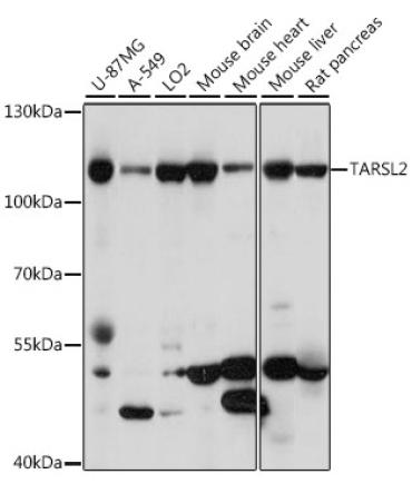 TARSL2 Rabbit Polyclonal Antibody