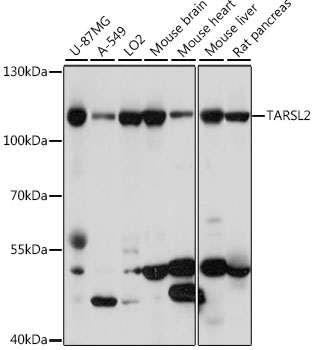 TARSL2 Rabbit Polyclonal Antibody