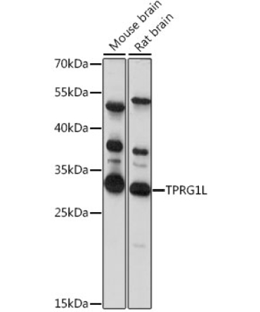 TPRG1L Rabbit Polyclonal Antibody
