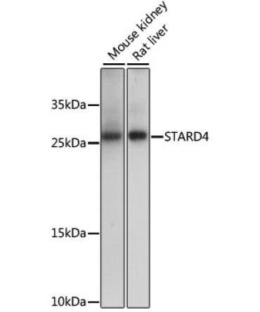 STARD4 Rabbit Polyclonal Antibody