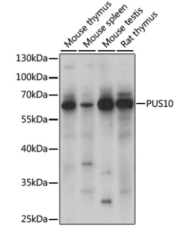 PUS10 Rabbit Polyclonal Antibody
